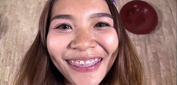  Thai teen smile with braces gets creampied